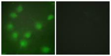 HOXA11+HOXD11 Antibody - Immunofluorescence analysis of HUVEC cells, using HOXA11/D11 Antibody. The picture on the right is blocked with the synthesized peptide.