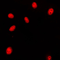 HOXA11+HOXD11 Antibody - Immunofluorescent analysis of HOXA11/D11 staining in HeLa cells. Formalin-fixed cells were permeabilized with 0.1% Triton X-100 in TBS for 5-10 minutes and blocked with 3% BSA-PBS for 30 minutes at room temperature. Cells were probed with the primary antibody in 3% BSA-PBS and incubated overnight at 4 C in a humidified chamber. Cells were washed with PBST and incubated with a DyLight 594-conjugated secondary antibody (red) in PBS at room temperature in the dark. DAPI was used to stain the cell nuclei (blue).