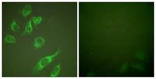 HOXA11+HOXD11 Antibody - Peptide - + Immunofluorescence analysis of HUVEC cells, using HOXA11/D11 antibody.