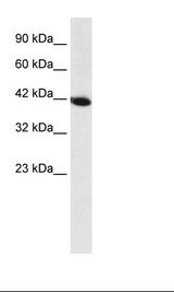 HOXA13 Antibody - Fetal Liver Lysate.  This image was taken for the unconjugated form of this product. Other forms have not been tested.
