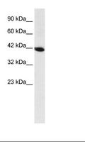 HOXA13 Antibody - Fetal Liver Lysate.  This image was taken for the unconjugated form of this product. Other forms have not been tested.