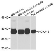 HOXA13 Antibody - Western blot analysis of extracts of various cells.