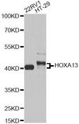 HOXA13 Antibody - Western blot analysis of extracts of various cell lines, using HOXA13 antibody at 1:1000 dilution. The secondary antibody used was an HRP Goat Anti-Rabbit IgG (H+L) at 1:10000 dilution. Lysates were loaded 25ug per lane and 3% nonfat dry milk in TBST was used for blocking. An ECL Kit was used for detection and the exposure time was 30s.