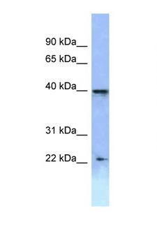 HOXA2 Antibody - HOXA2 antibody Western blot of ACHN Cell lysate. Antibody concentration 1 ug/ml.  This image was taken for the unconjugated form of this product. Other forms have not been tested.