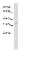 HOXA2 Antibody - Fetal Skeletal Muscle Lysate.  This image was taken for the unconjugated form of this product. Other forms have not been tested.