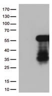 HOXA2 Antibody - HEK293T cells were transfected with the pCMV6-ENTRY control. (Left lane) or pCMV6-ENTRY HOXA2. (Right lane) cDNA for 48 hrs and lysed. Equivalent amounts of cell lysates. (5 ug per lane) were separated by SDS-PAGE and immunoblotted with anti-HOXA2. (1:500)
