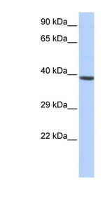 HOXA2 Antibody - HOXA2 antibody Western blot of Jurkat lysate. This image was taken for the unconjugated form of this product. Other forms have not been tested.