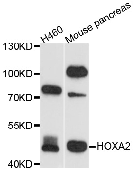 HOXA2 Antibody - Western blot analysis of extracts of various cell lines.