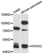 HOXA2 Antibody - Western blot analysis of extracts of various cell lines.