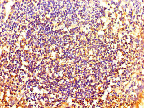 HOXA2 Antibody - Immunohistochemistry of paraffin-embedded human tonsil tissue using HOXA2 Antibody at dilution of 1:100