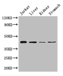 HOXA2 Antibody - Positive WB detected in:Jurkat whole cell lysate,Mouse liver tissue,Mouse kidney tissue,Mouse stomach tissue;All lanes: Hoxa2 antibody at 2ug/ml;Secondary;Goat polyclonal to rabbit IgG at 1/50000 dilution;Predicted band size: 42 kDa;Observed band size: 42 kDa;