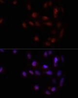 HOXA2 Antibody - Immunofluorescence analysis of U2OS cells using HOXA2 Polyclonal Antibody at dilution of 1:100.Blue: DAPI for nuclear staining.