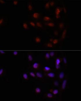 HOXA2 Antibody - Immunofluorescence analysis of U2OS cells using HOXA2 Polyclonal Antibody at dilution of 1:100.Blue: DAPI for nuclear staining.