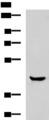 HOXA2 Antibody - Western blot analysis of Human muscle tissue lysate  using HOXA2 Polyclonal Antibody at dilution of 1:800