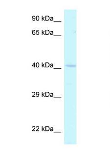 HOXA2 Antibody - HOXA2 antibody Western blot of Mouse Heart lysate. Antibody concentration 1 ug/ml.  This image was taken for the unconjugated form of this product. Other forms have not been tested.