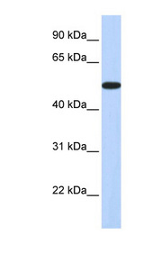 HOXA3 Antibody - HOXA3 antibody Western blot of Fetal Brain lysate. This image was taken for the unconjugated form of this product. Other forms have not been tested.