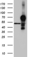 HOXA3 Antibody - HEK293T cells were transfected with the pCMV6-ENTRY control. (Left lane) or pCMV6-ENTRY HOXA3. (Right lane) cDNA for 48 hrs and lysed. Equivalent amounts of cell lysates. (5 ug per lane) were separated by SDS-PAGE and immunoblotted with anti-HOXA3. (1:2000)