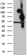 HOXA3 Antibody - HEK293T cells were transfected with the pCMV6-ENTRY control. (Left lane) or pCMV6-ENTRY HOXA3. (Right lane) cDNA for 48 hrs and lysed
