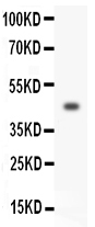 HOXA3 Antibody - Western blot - Anti-HOXA3 Antibody