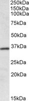 HOXA4 Antibody - HOXA4 antibody (0.1 ug/ml) staining of Human Colon lysate (35 ug protein/ml in RIPA buffer). Primary incubation was 1 hour. Detected by chemiluminescence.