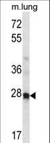 HOXA4 Antibody - Mouse Hoxa4 Antibody western blot of mouse lung tissue lysates (35 ug/lane). The Hoxa4 antibody detected the Hoxa4 protein (arrow).
