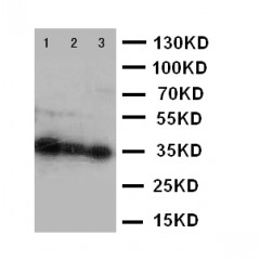 HOXA4 Antibody - WB of HOXA4 antibody. Lane 1: SW620 Cell Lysate. Lane 2: SW620 Cell Lysate. Lane 3: PC-12 Cell Nuclear Lysate.