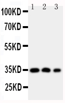 HOXA4 Antibody - Anti-HOXA4 antibody, Western blotting Lane 1: SW620 Cell Lysate Lane 2: SW620 Cell LysateLane 3: PC-12 Cell Nuclear Lysate
