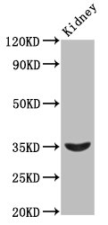 HOXA4 Antibody - Positive Western Blot detected in Rat kidney tissue. All lanes: HOXA4 antibody at 2.3 µg/ml Secondary Goat polyclonal to rabbit IgG at 1/50000 dilution. Predicted band size: 35 KDa. Observed band size: 35 KDa
