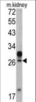 HOXA5 Antibody - Western blot of HOXA5 antibody (C-term E211) in mouse kidney tissue lysates (35 ug/lane). HOXA5 (arrow) was detected using the purified antibody.