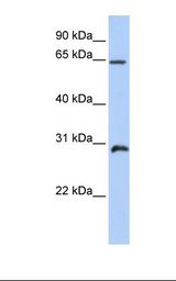 HOXA5 Antibody - Placenta lysate. Antibody concentration: 1.0 ug/ml. Gel concentration: 12%.  This image was taken for the unconjugated form of this product. Other forms have not been tested.