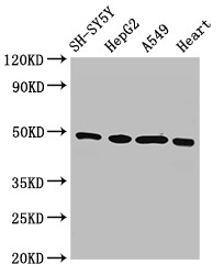 HOXA5 Antibody - Positive WB detected in:SH-SY5Y whole cell lysate,HepG2 whole cell lysate,A549 whole cell lysate,Rat heart tissue;All lanes:HOXA5 antibody at 3?g/ml;Secondary;Goat polyclonal to rabbit IgG at 1/50000 dilution;Predicted band size: 30 KDa;Observed band size: 49 KDa;