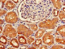 HOXA5 Antibody - Immunohistochemistry of paraffin-embedded human kidney tissue using HOXA5 Antibody at dilution of 1:100