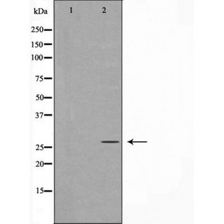 HOXA5 Antibody - Western blot analysis of extracts of Jurkat cells using HXA5 antibody. The lane on the left is treated with the antigen-specific peptide.
