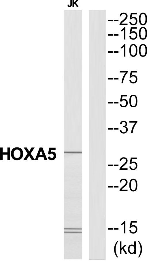 HOXA5 Antibody - Western blot analysis of extracts from Jurkat cells, using HXA5 antibody.
