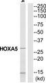 HOXA5 Antibody - Western blot analysis of extracts from Jurkat cells, using HXA5 antibody.