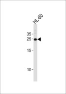 HOXA6 Antibody - HOXA6 Antibody western blot of HL-60 cell line lysates (35 ug/lane). The HOXA6 antibody detected the HOXA6 protein (arrow).