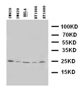 HOXA6 Antibody - WB of HOXA6 antibody. Lane 1ï¼šSW620 Cell Lysate. Lane 2: SW620 Cell Lysate. Lane 3ï¼šHELA Cell Lysate. Lane 4ï¼šHT1080 Cell Lysate. Lane 5ï¼šHT1080 Cell Lysate.