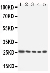 HOXA6 Antibody - Anti-HOXA6 antibody, Western blotting Lane 1: SW620 cell LysateLane 2: SW620 cell LysateLane 3: HELA cell LysateLane 4: HT1080 cell LysateLane 5: HT1080 cell Lysate