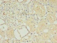 HOXA6 Antibody - Immunohistochemistry of paraffin-embedded human kidney tissue using antibody at 1:100 dilution.  This image was taken for the unconjugated form of this product. Other forms have not been tested.