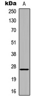 HOXA6 Antibody - Western blot analysis of HOXA6 expression in K562 (A) whole cell lysates.