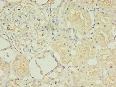 HOXA6 Antibody - Immunohistochemistry of paraffin-embedded human kidney tissue using HOXA6 Antibody at dilution of 1:100