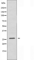HOXA6 Antibody - Western blot analysis of extracts of HT29 cells using HOXA6 antibody.