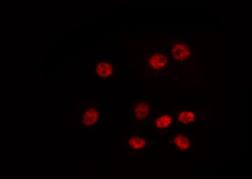 HOXA6 Antibody - Staining LOVO cells by IF/ICC. The samples were fixed with PFA and permeabilized in 0.1% Triton X-100, then blocked in 10% serum for 45 min at 25°C. The primary antibody was diluted at 1:200 and incubated with the sample for 1 hour at 37°C. An Alexa Fluor 594 conjugated goat anti-rabbit IgG (H+L) Ab, diluted at 1/600, was used as the secondary antibody.