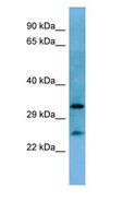 HOXA6 Antibody - HOXA6 antibody Western Blot of Mouse Heart.  This image was taken for the unconjugated form of this product. Other forms have not been tested.