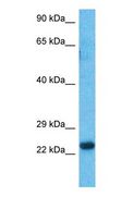 HOXA6 Antibody - Western blot of HXA6 Antibody with human Fetal Liver lysate.  This image was taken for the unconjugated form of this product. Other forms have not been tested.