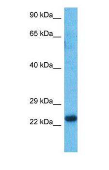 HOXA6 Antibody - Western blot of HXA6 Antibody with human Fetal Liver lysate.  This image was taken for the unconjugated form of this product. Other forms have not been tested.