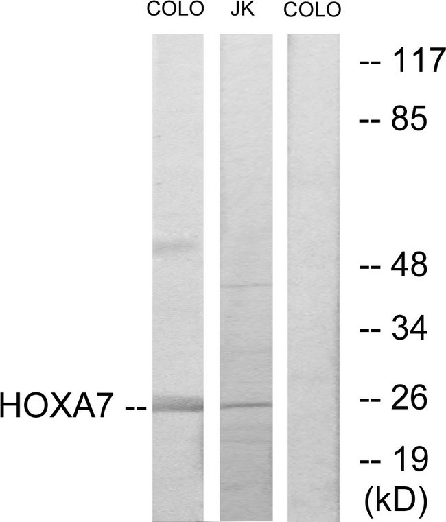 HOXA7 Antibody - Western blot analysis of lysates from COLO205 and Jurkat cells, using HOXA7 Antibody. The lane on the right is blocked with the synthesized peptide.