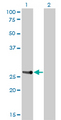HOXA7 Antibody - Western Blot analysis of HOXA7 expression in transfected 293T cell line by HOXA7 monoclonal antibody (M01), clone 2F2.Lane 1: HOXA7 transfected lysate(25.4 KDa).Lane 2: Non-transfected lysate.