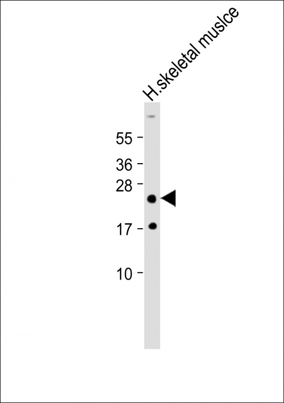 HOXA7 Antibody - Anti-HOXA7 Antibody (Center) at 1:2000 dilution + Human skeletal muslce lysate Lysates/proteins at 20 µg per lane. Secondary Goat Anti-Rabbit IgG, (H+L), Peroxidase conjugated at 1/10000 dilution. Predicted band size: 25 kDa Blocking/Dilution buffer: 5% NFDM/TBST.