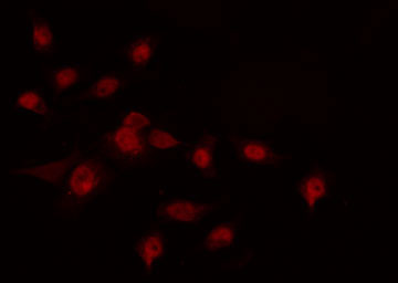HOXA7 Antibody - Staining COLO205 cells by IF/ICC. The samples were fixed with PFA and permeabilized in 0.1% Triton X-100, then blocked in 10% serum for 45 min at 25°C. The primary antibody was diluted at 1:200 and incubated with the sample for 1 hour at 37°C. An Alexa Fluor 594 conjugated goat anti-rabbit IgG (H+L) antibody, diluted at 1/600, was used as secondary antibody.